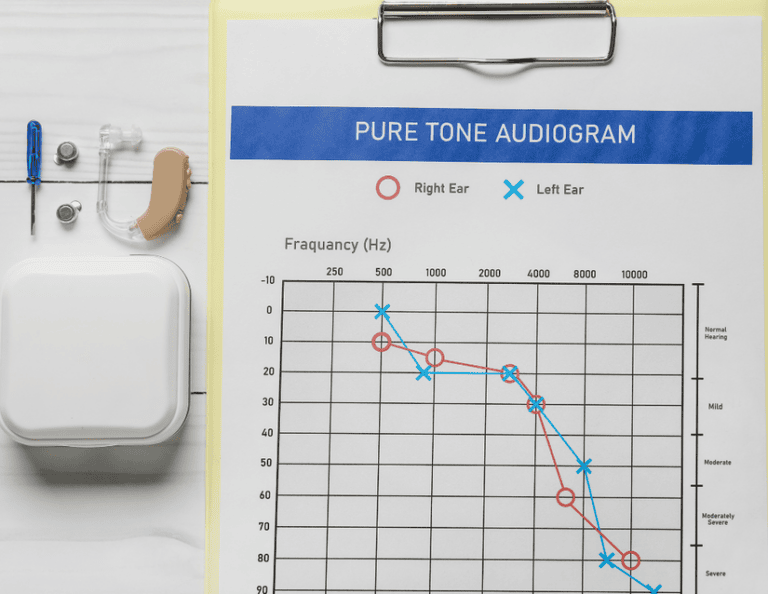 How to Read an Audiogram