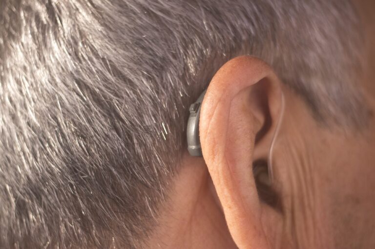 New Hearing Aid Manufacturers Offer Devices Online—Here’s What You Need to Know