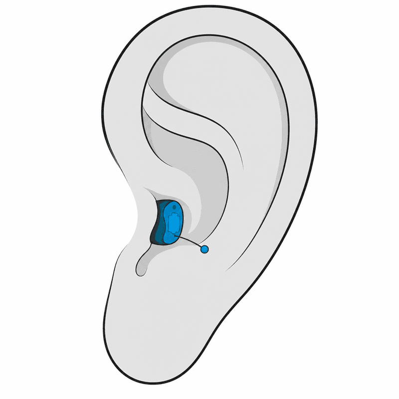 Completely-in-Canal (CIC) hearing aid style