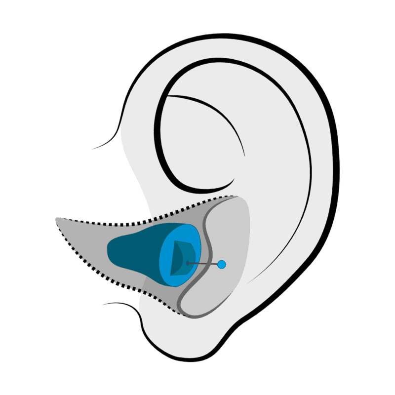 Invisible-in-Canal (IIC) hearing aid style