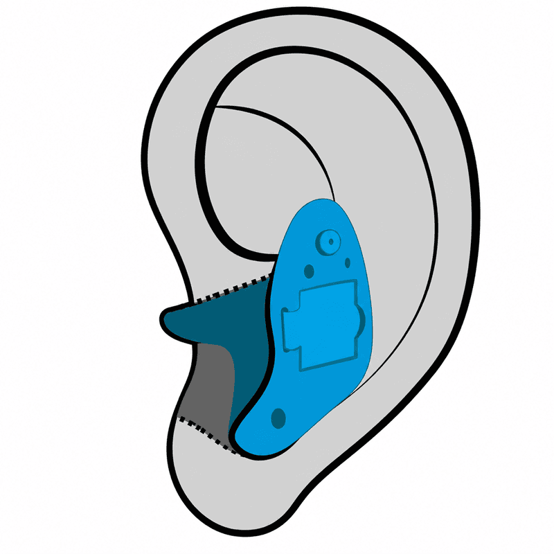 In-the-Ear (ITE) hearing aid style